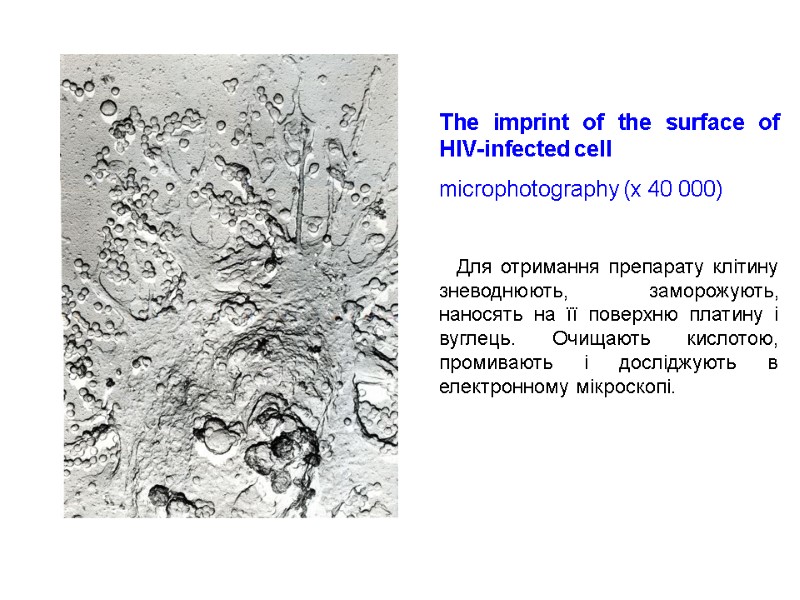 The imprint of the surface of HIV-infected cell microphotography (х 40 000)  